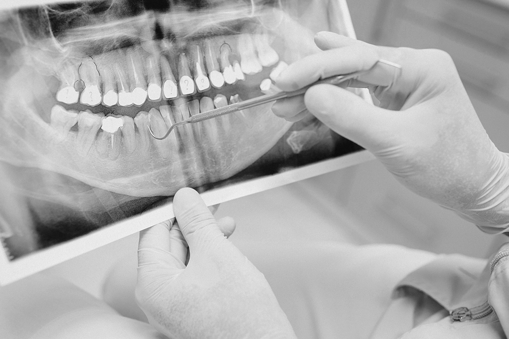 Ortodoncia Clínica Dental 