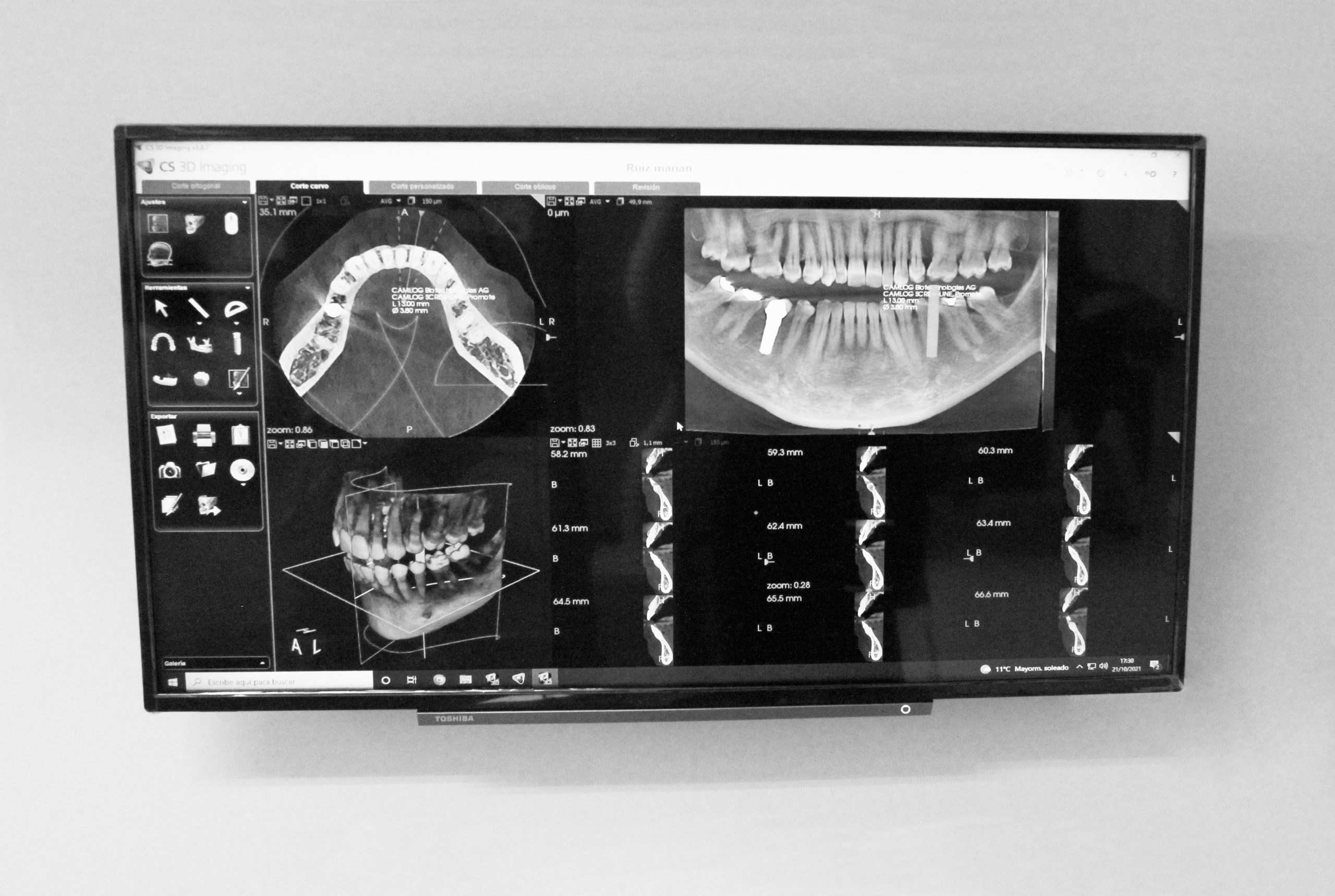 Clínica Dental Recarey de Viana Molina de Aragón